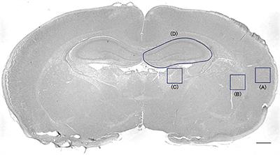 Administration of Bone Marrow-Derived Mononuclear Cells Contributed to the Reduction of Hypoxic-Ischemic Brain Injury in Neonatal Rats